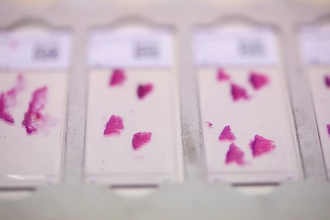 Embedded samples in a histology laboratory