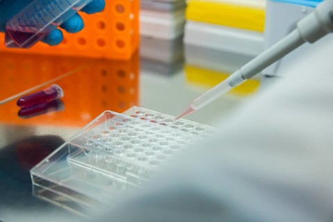 Medical laboratory assistant fills samples onto a multiwell tray with a pipette
