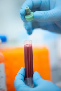 Medical laboratory assistant holding a tube with blood
