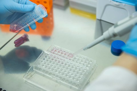 Medical laboratory assistant takes samples from a centrifuge tube with a pipette and fills them into a multiwell tray