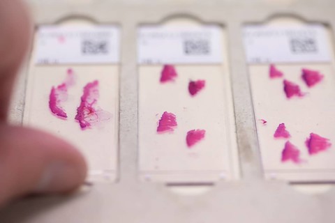Embedded samples in a histology laboratory