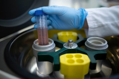 Hand of a medical laboratory assistant takes a centrifuge tube with liquid out of the centrifuge