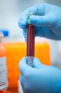 Medical laboratory assistant holding a tube with blood