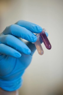 Medical laboratory assistant holding 2 reaction vessels with samples