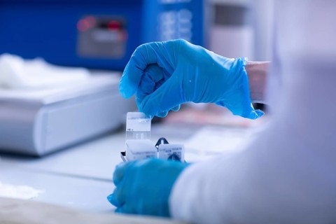 Processing of samples in a histology laboratory