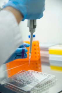 Medical laboratory assistant takes samples from a reaction vessel and fills them into a multiwell tray with a pipette