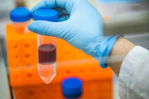 Medical laboratory assistant holding a centrifuge tube with blood