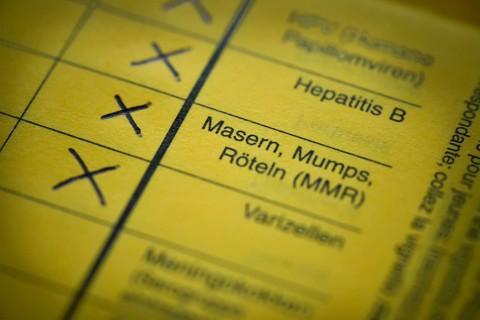 Measles