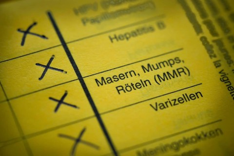 Measles