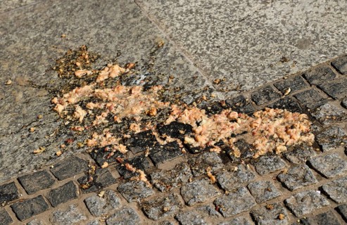 Vomit