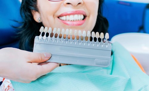 Cosmetological teeth whitening in a dental clinic