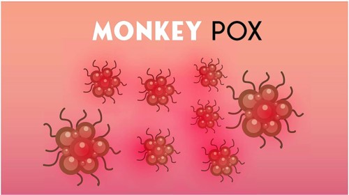 Monkeypox virus illustration