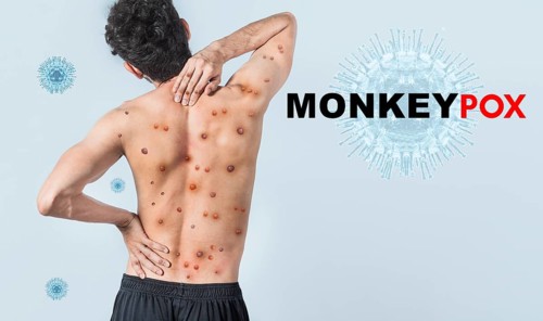 People with monkeypox on isolated background