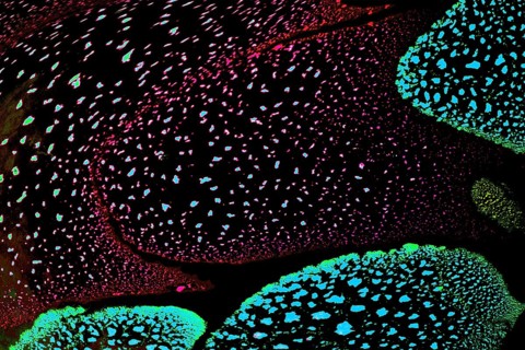 Oil bubbles inside water base form patterns