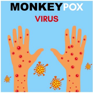 Monkeypox virus Illustration
