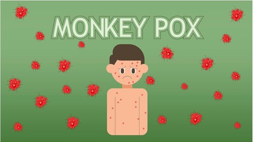 Monkeypox concept