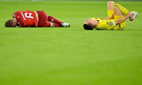 Verletzung nach Zweikampf Joshua Kimmich FC Bayern Muenchen FCB