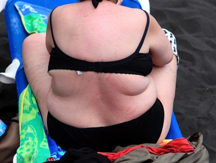 Back of an overweight woman