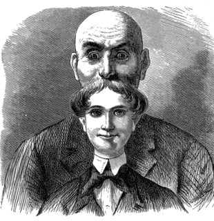 Hair growth in youth and old age, Comparison