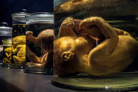 Collection of glass jars with foetuses preserved in formalin at different stages of growth