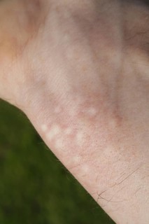 Stinging nettle