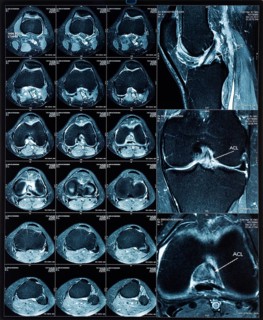 Magnetic resonance tomography