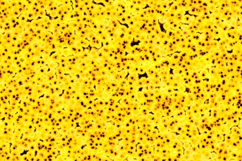 Shape of bacterial cell: cocci