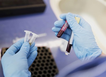 Close up doctor holding tube with blood