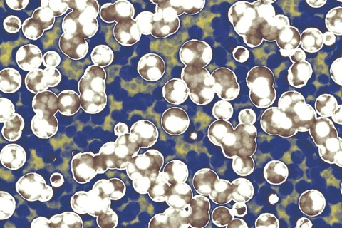 Shape of bacterial cell: cocci