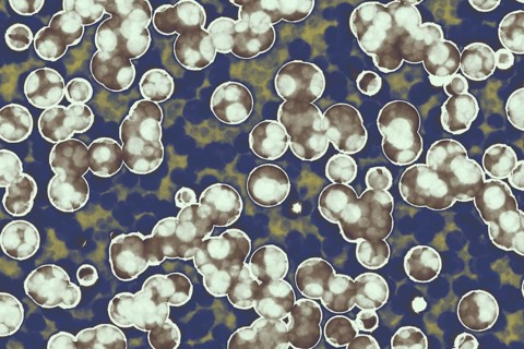 Shape of bacterial cell: cocci