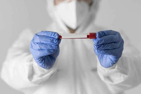 Close up doctor holding blood sample