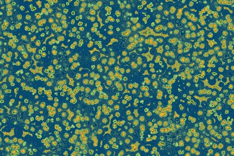 Shape of bacterial cell: cocci