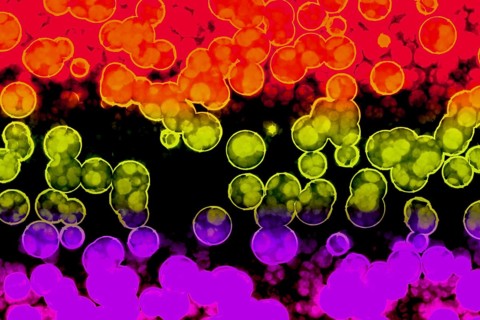Shape of bacterial cell: cocci