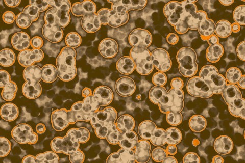 Shape of bacterial cell: cocci