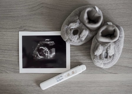 Cute little shoes x ray photo