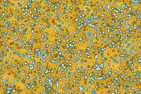 Shape of bacterial cell: cocci