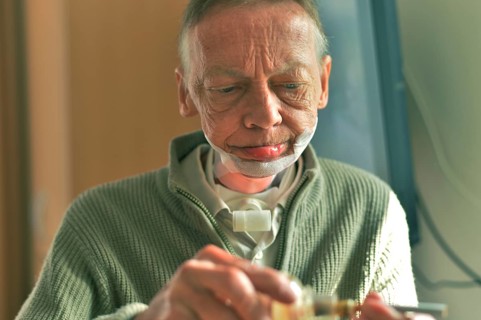 The Mother Theresa Hospice offers its guests a dignified home in a new friendly ambience for the patients in their last stage of life. This patient with a carcinoma of the floor of the mouth caused by...