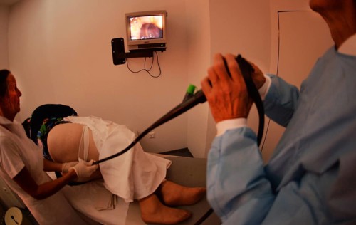Colonoscopy