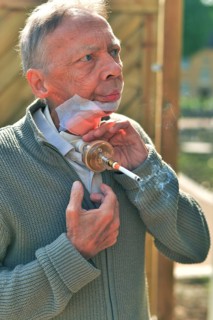 The Mother Theresa Hospice offers its guests a dignified home in a new friendly ambience for patients in their last phase of life. This patient with carcinoma of the floor of the mouth caused by smoki...