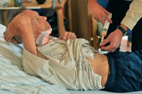 The Mother Theresa Hospice offers its guests a dignified home in a new friendly ambience for the patients in their last stage of life. This patient with carcinoma of the floor of the mouth caused by s...
