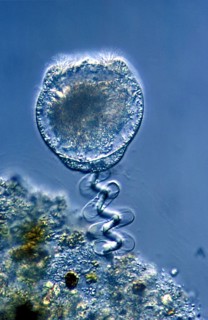 Vorticella