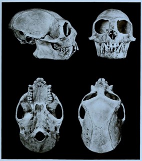 Skull bone