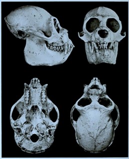 Skull bone