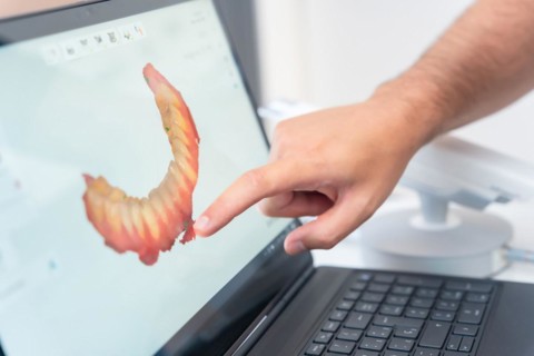 A doctor in the dental clinic explaining and looking at the 3d of the x-ray on the computer