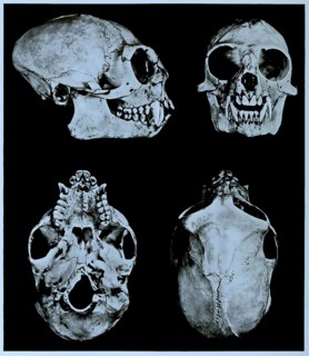 Skull bone