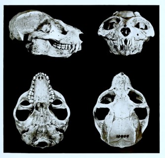 Skull bone