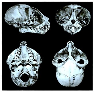 Skull bone