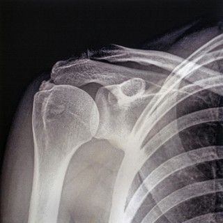 Old mid 20th century X-ray photograph
