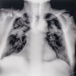 Old mid 20th century X-ray photograph