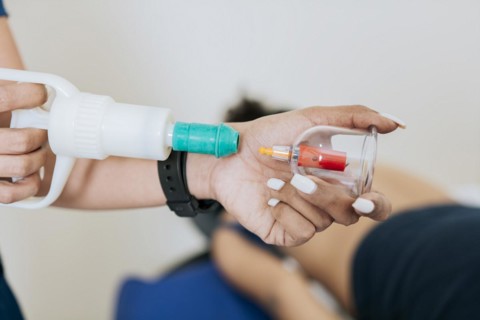 Close up of professional performing cupping treatment on patient